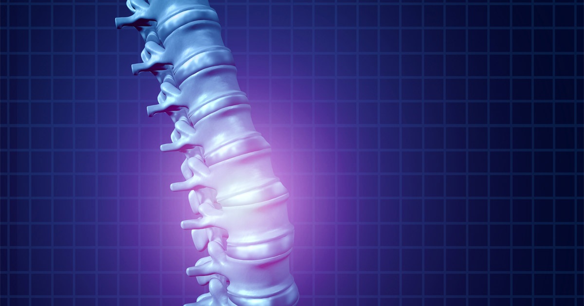 Contact a Skilled Media Car Accident Lawyer at Eckell Sparks for Legal Guidance on a Spinal Cord Injury